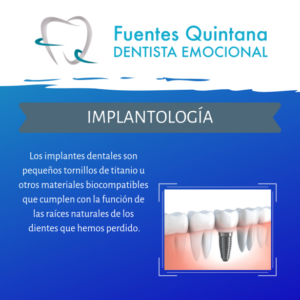 Implantología FQ