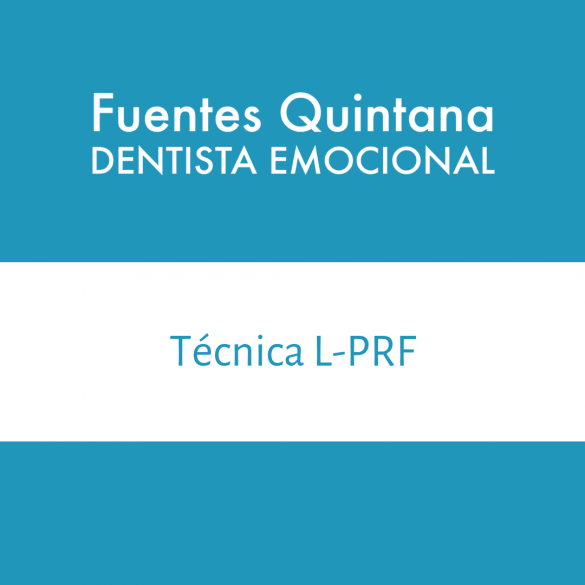Técnica L PRF