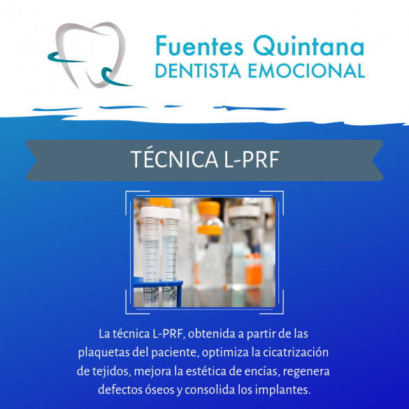 Técnica L PRF FQ