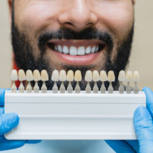 dental care implants for veneers man with perfec 2021 12 09 04 31 31 utc (1) (1)